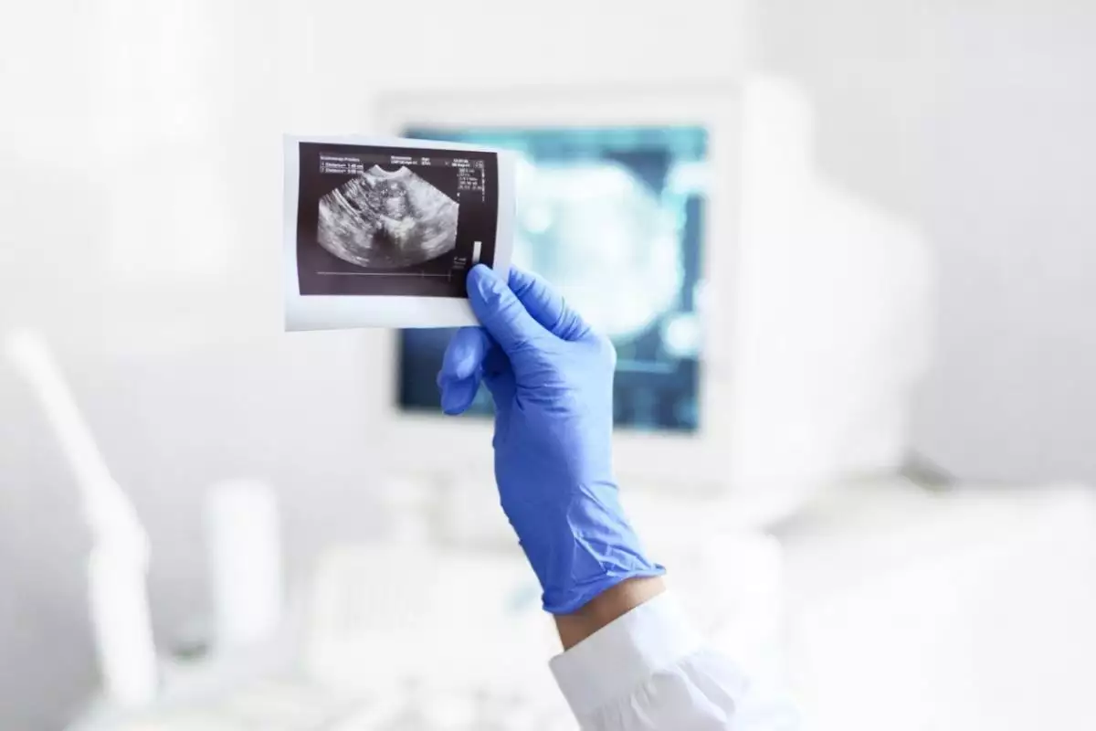 Бесконтактное лазерное УЗИ впервые испытали на человеке: в чем отличие от стандартного метода