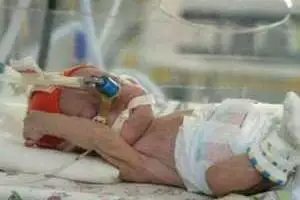 Единственный на Донбассе кардиоцентр, спасающий младенцев, закрылся в Донецке 